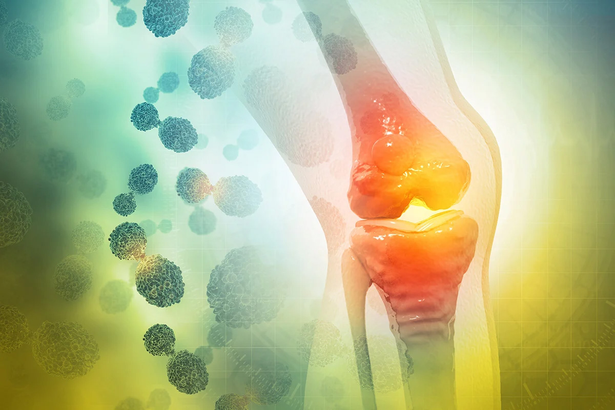 Bone Joint Inflammation
